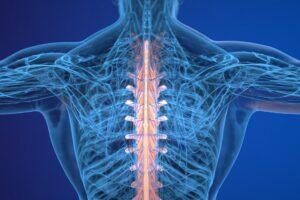 xray of a spine